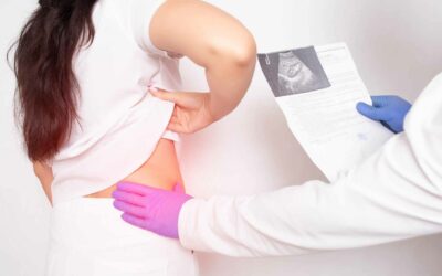 La colique néphrétique et les calculs rénaux