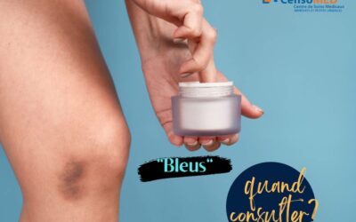 Hématome, « bleu » : quand est-il une petite urgence ?
